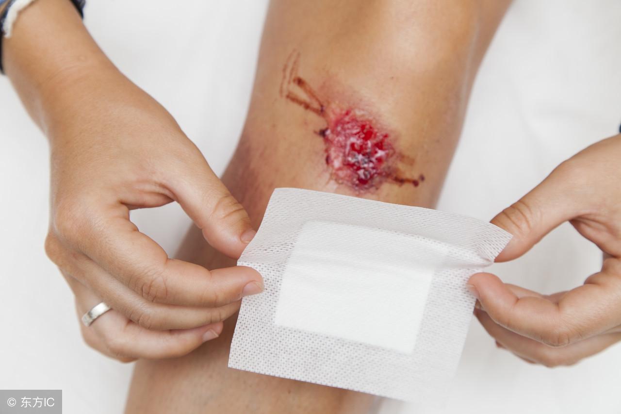 落地生根什么時(shí)候開(kāi)花，落地生根怎么治痔瘡?