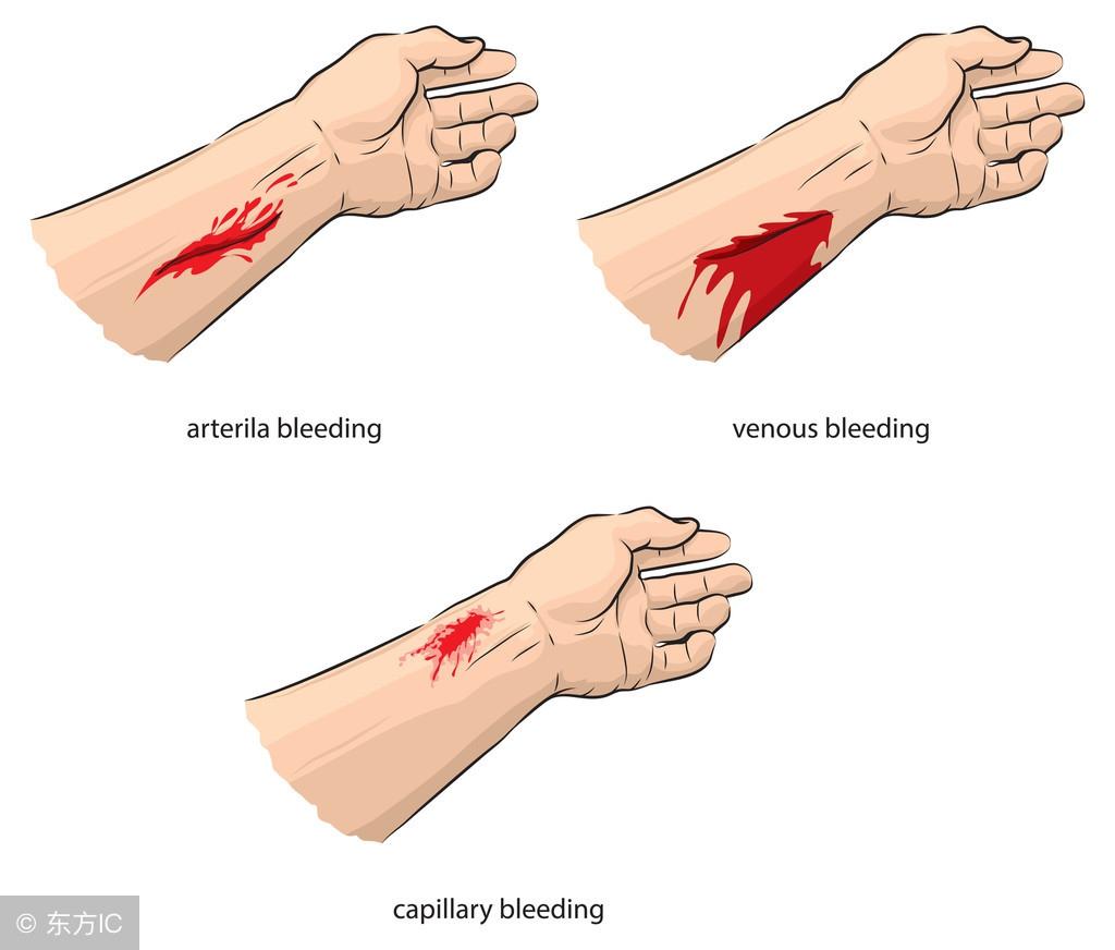 落地生根什么時(shí)候開(kāi)花，落地生根怎么治痔瘡?